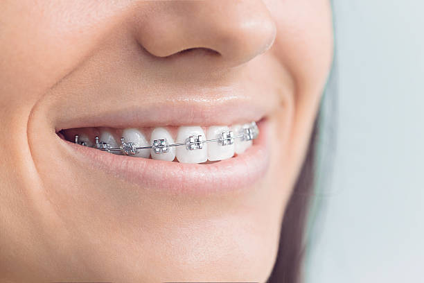Best Tooth Extraction  in Munster, IN